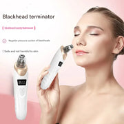 Electric Blackhead Remover
